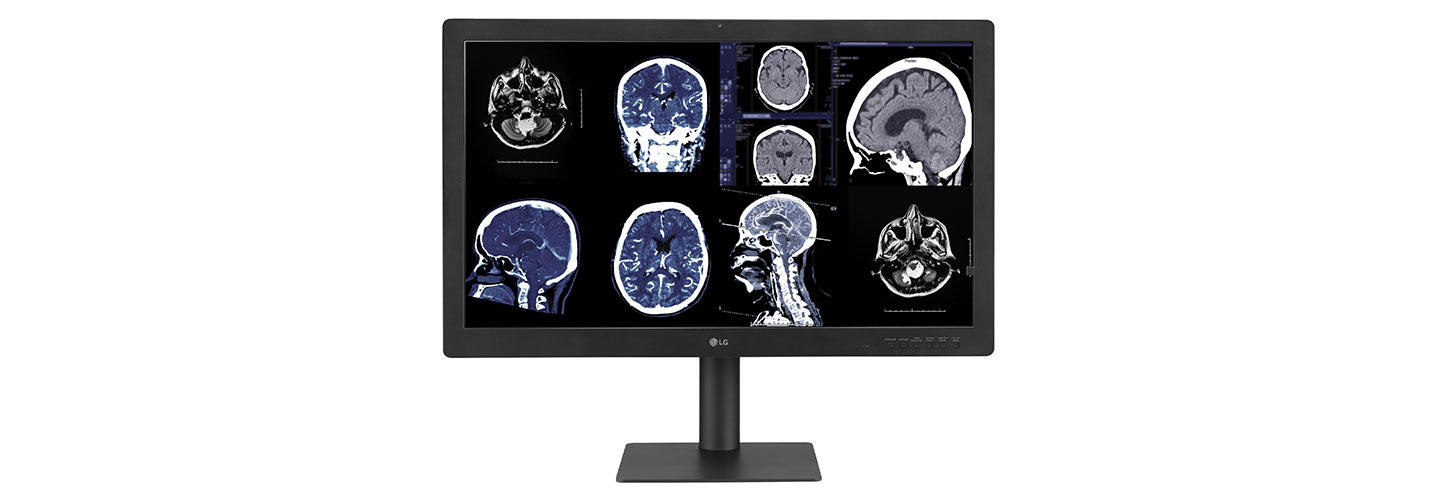 Medical images display on LG Diagnostic Monitor 32HQ713D