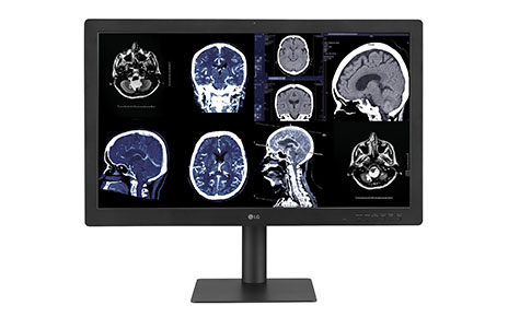 Medical images display on LG Diagnostic Monitor 32HQ713D