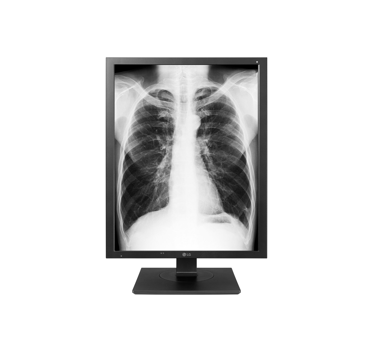 LG UNVEILS EXPANDED MEDICAL IMAGING PRODUCT LINEUP AT MEDICA 2017