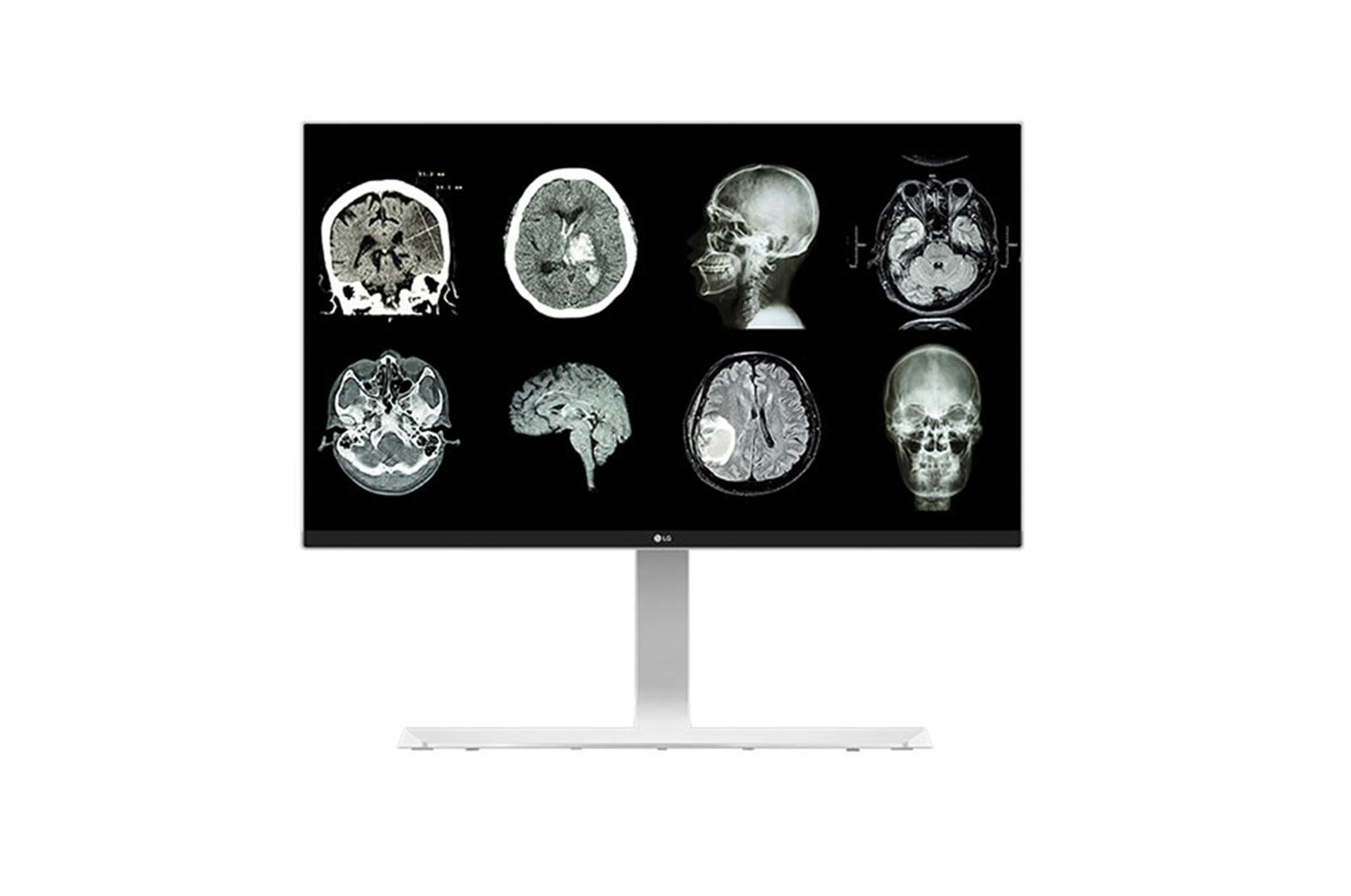 Front view of LG 27 (68.58cm) UHD 8MP Clinical Review Monitor 27HJ712C-W