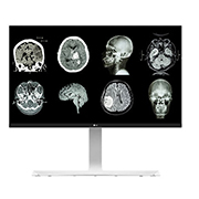 Front view of LG 27 (68.58cm) UHD 8MP Clinical Review Monitor 27HJ712C-W